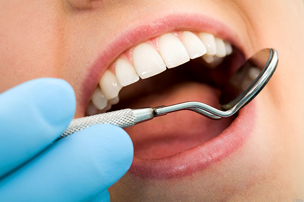 Отбеливание зубов: стоит ли обратиться ко врачу?